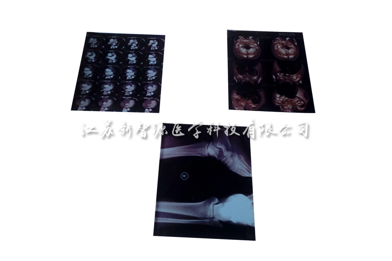 Medical printing film